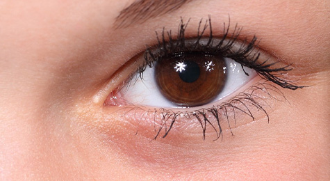 Dark Circle Under Eye Treatment